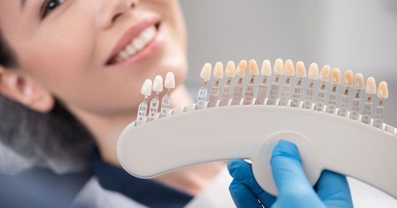 Cosmetic Dental Work010